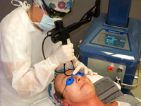 Operační frakční CO2 laser